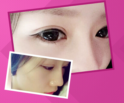 ۽ҪǮ