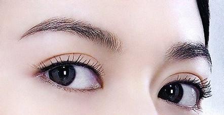 美容双眼皮价格要多少钱