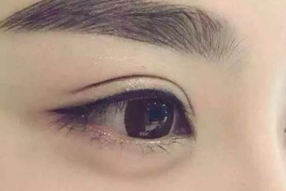 韩式翘睫双眼皮的费用是多少