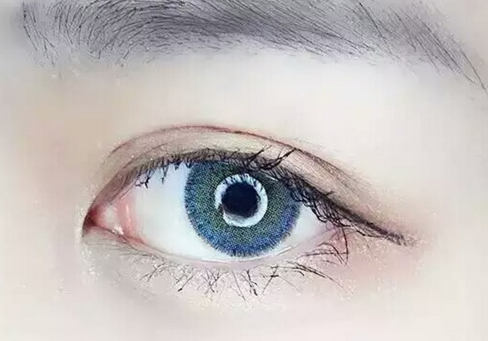 做双眼皮开眼角需多长时间 做双眼皮开眼角需多长时间