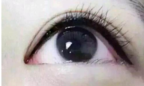 埋眼线有什么坏处