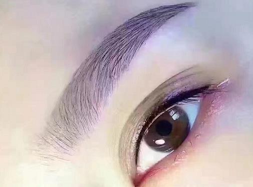双眼皮整形痛不痛