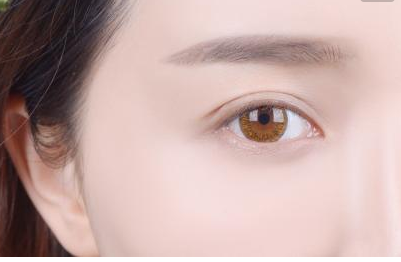去眼袋黑眼圈能管多久 去眼袋黑眼圈能管多久