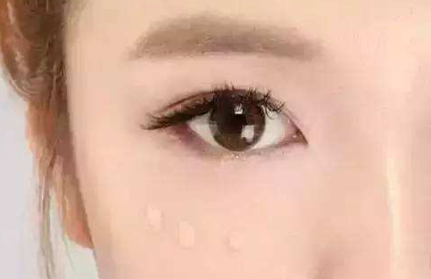 去眼袋黑眼圈能维持多久