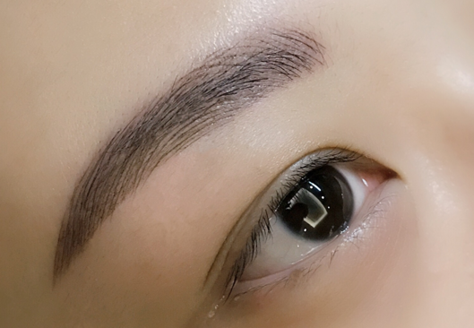 割眼袋留疤吗 割眼袋留疤吗