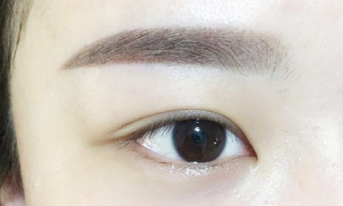 溶脂去眼袋的缺点