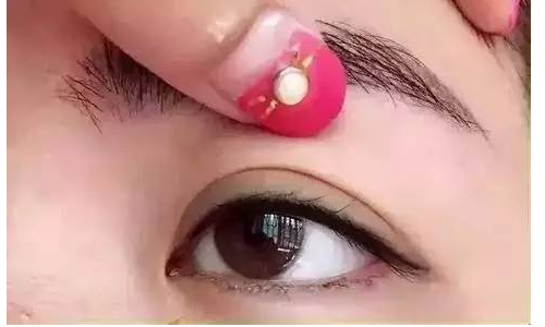 超声法祛眼袋注意事项