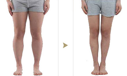 抽大腿脂肪一般多少钱 抽大腿脂肪一般多少钱