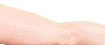 大腿吸脂的风险