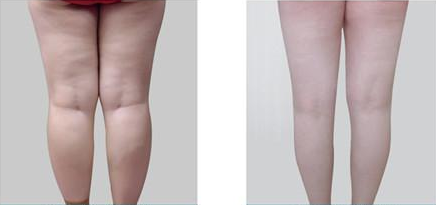 把腿靠在墙上能瘦腿吗