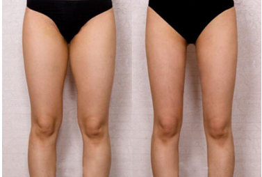 男生怎样瘦大腿而不是锻炼肌肉 男生怎样瘦大腿而不是锻炼肌肉