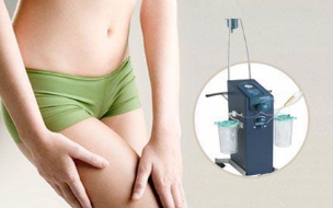 大腿可不可以抽脂呢 大腿可不可以抽脂呢