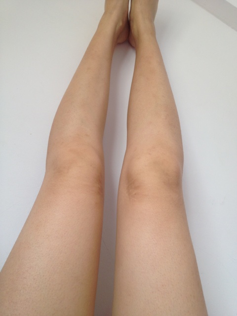 腿部吸脂手术价格是多少 腿部吸脂手术价格是多少