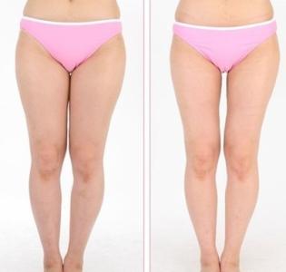 抽脂瘦腿的安全性及恢复过程如何