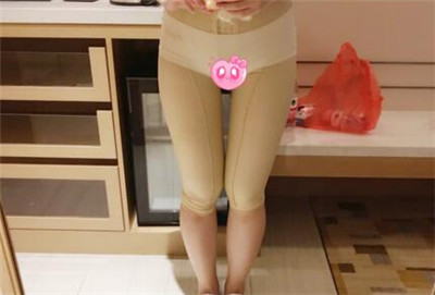 腿部吸脂7天效果恢复图 腿部吸脂7天效果恢复图