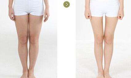 大腿注射瘦腿价格