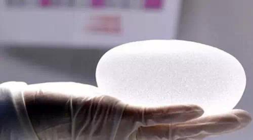 乳房假体取出手术恢复要多久 乳房假体取出手术恢复要多久