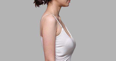 胸下垂怎么矫正