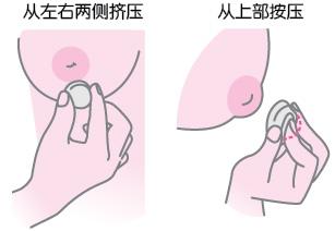 做乳头内陷矫正术哪家好 做乳头内陷矫正术哪家好