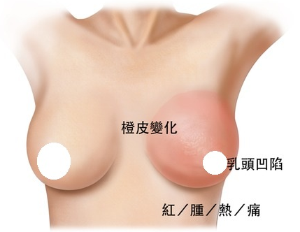 Ů����ͷ���ݵ�ԭ����Σ��