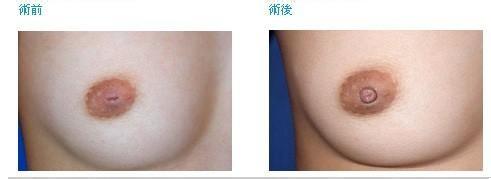 ΢��������������ͷ����