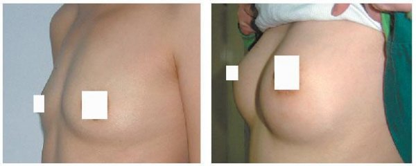 ��ô���ܷ�ֹ��ͷ����