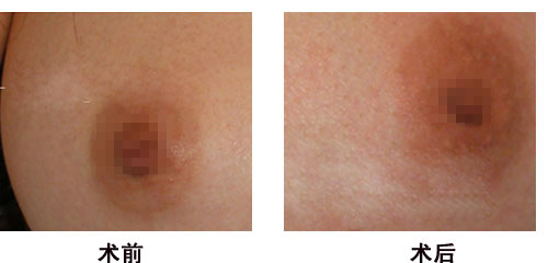 ��������α�����ͷ���ݵ�Σ��