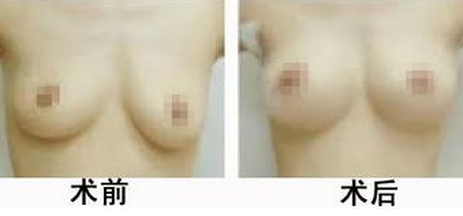 ��ͷ������������Ǯ