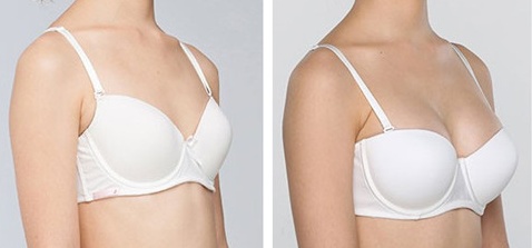 �鷿�޸����ܴﵽʲôЧ��