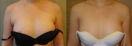 ���ַ�������ȥ������