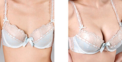 �����ز���ˮ��Ԥ����ʽ����Щ