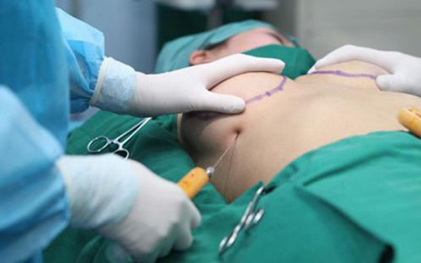 做乳房切除再造价格是多少 做乳房切除再造价格是多少