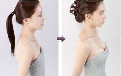 ����¡����Ҫע��ʲô