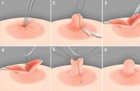 ��ͷ������ô��