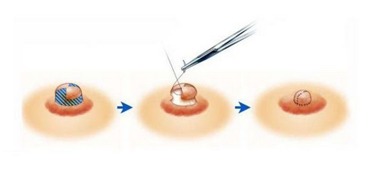 ��ͷ������ô��