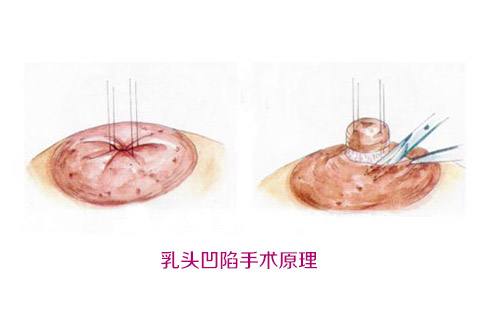 ��ͷ���ݽ�����Ч������