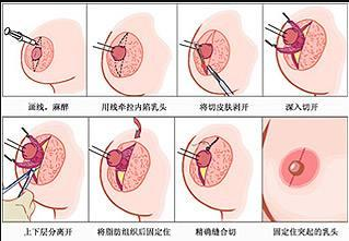 ��ͷ���ݽ����������