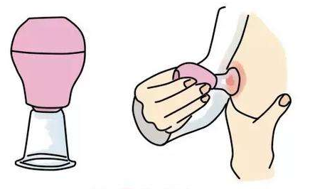 ��ͷ���ݽ�����Ҫ��ûָ�