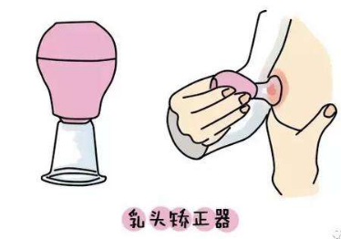 乳头内陷矫正有后遗症吗 乳头内陷矫正有后遗症吗