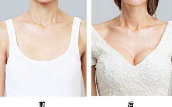 做乳房下垂纠正一般要多少钱