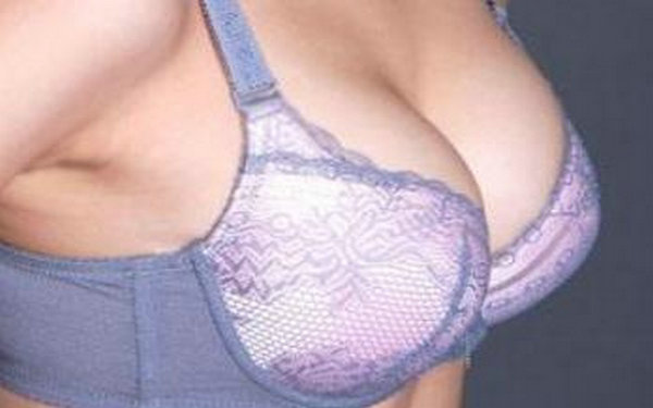 乳房下垂提升术及适合人群