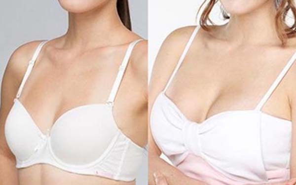 产后乳房下垂松弛