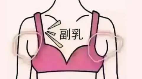 武汉去副乳哪家美容机构好? 武汉去副乳哪家美容机构好?