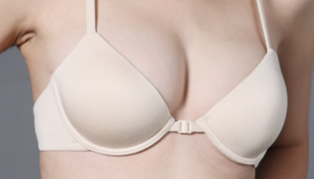 副乳用不用去切除 副乳用不用去切除