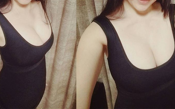 副乳吸脂手术的年龄