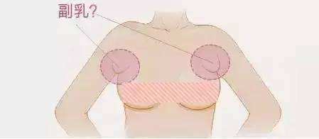 做副乳吸脂手术哪里好