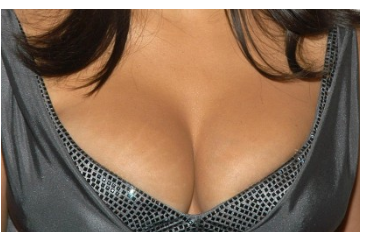 做副乳切除整形医院哪里好 做副乳切除整形医院哪里好