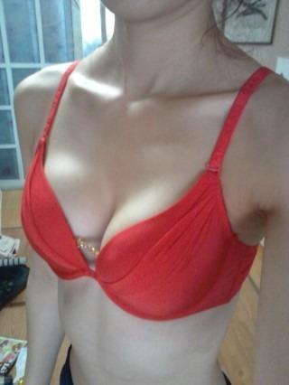 去除副乳效果好不好 去除副乳效果好不好