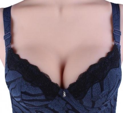 副乳切除手术的注意事项