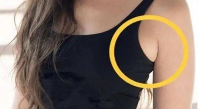 副乳长什么样子图片 副乳长什么样子图片